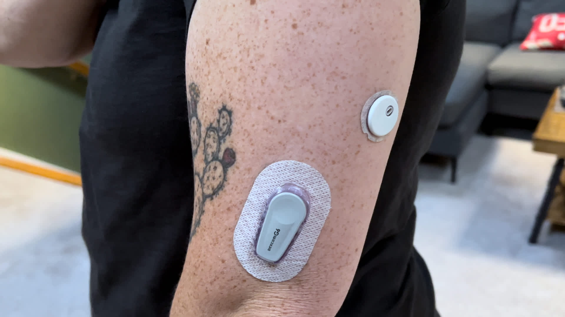Dexcom announces Stelo has been cleared by the FDA