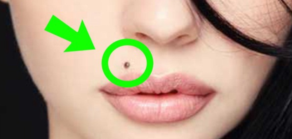 Here’s What It Means, If You Have A Mole In One Of These 7 Places On Your Body