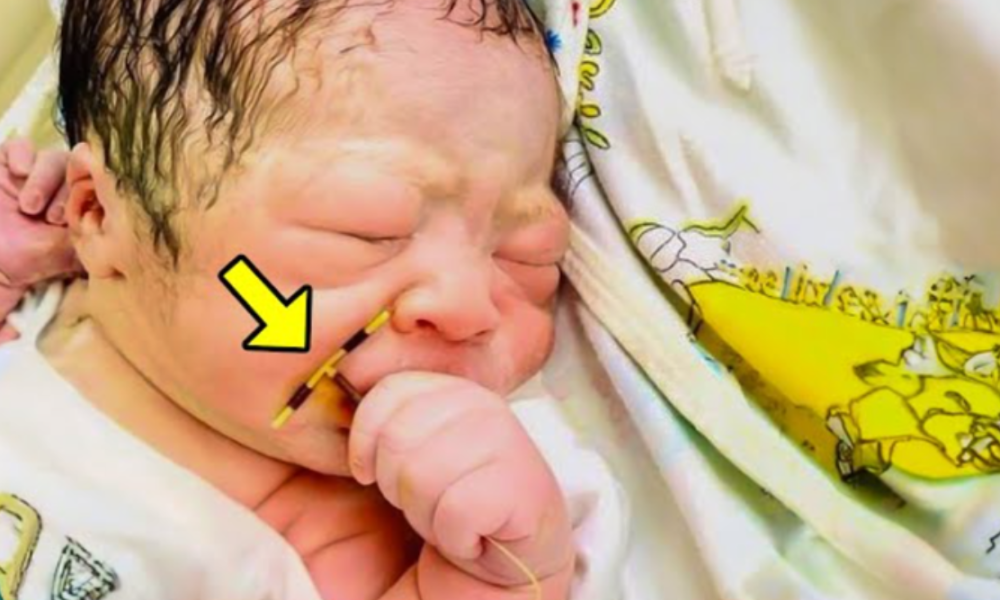 Baby Was Born With Something In Her Hands. Doctors Were Horrified When They Discovered What It Was!