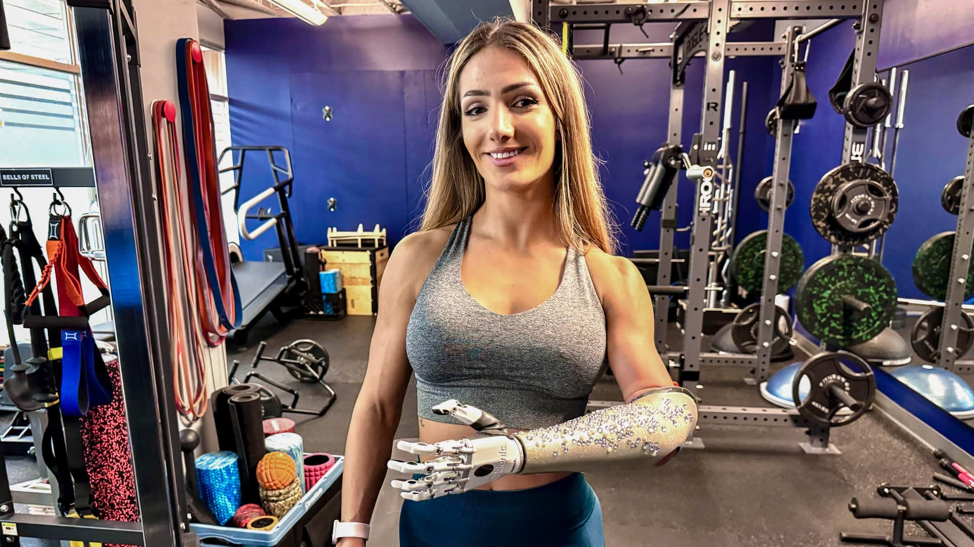 Bodybuilder with bionic prosthetic ‘an inspiration’ as gym trainer