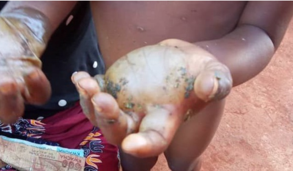 Boy, 7, dies after grandparent burnt his both hands for eating her kanyenya