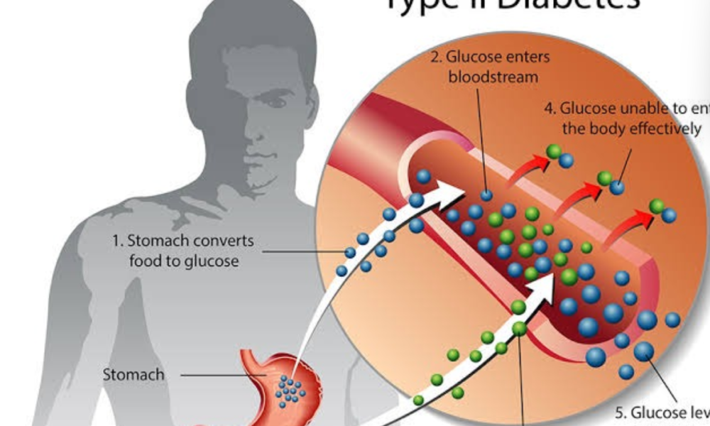 Check Out How Diabetic Mellitus Type 2 Affect Human Body