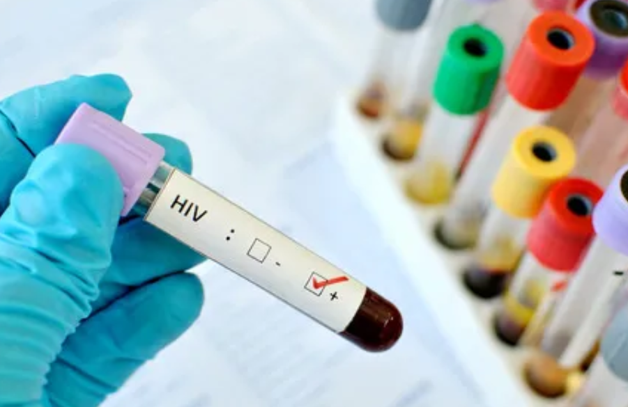 Four Behaviors That Increase Your Risk Of Developing HIV