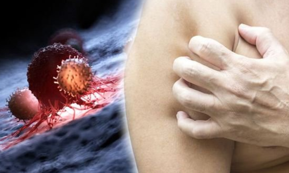 Here’s When Itching Can Be A Sign Of Cancer And What To Do About It