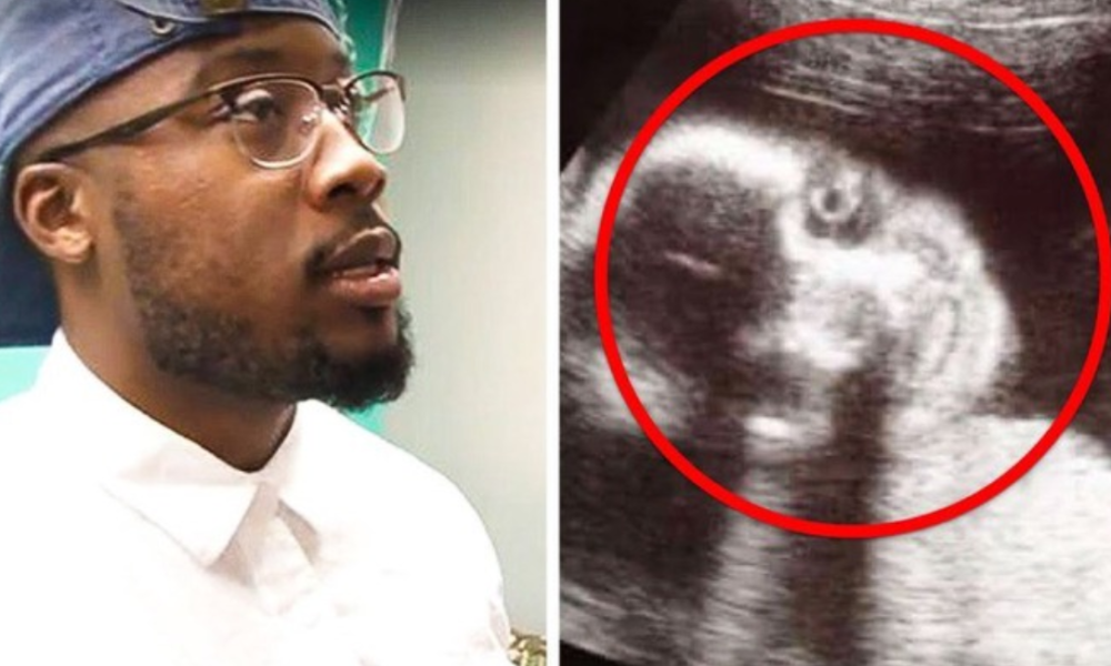 Man Thought His Wife Was Having A Baby, And Fainted When The Doctors Told Him What It Was.