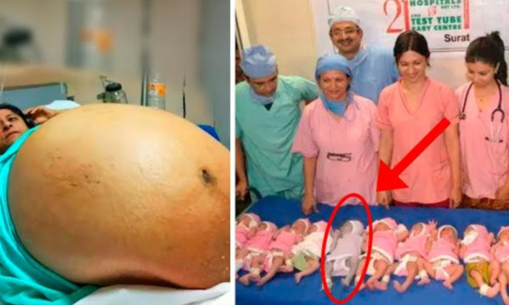 Mother Gives Birth to 10 Babies and Doctors Realize One of Them Isn’t a Baby! Biggest Shock