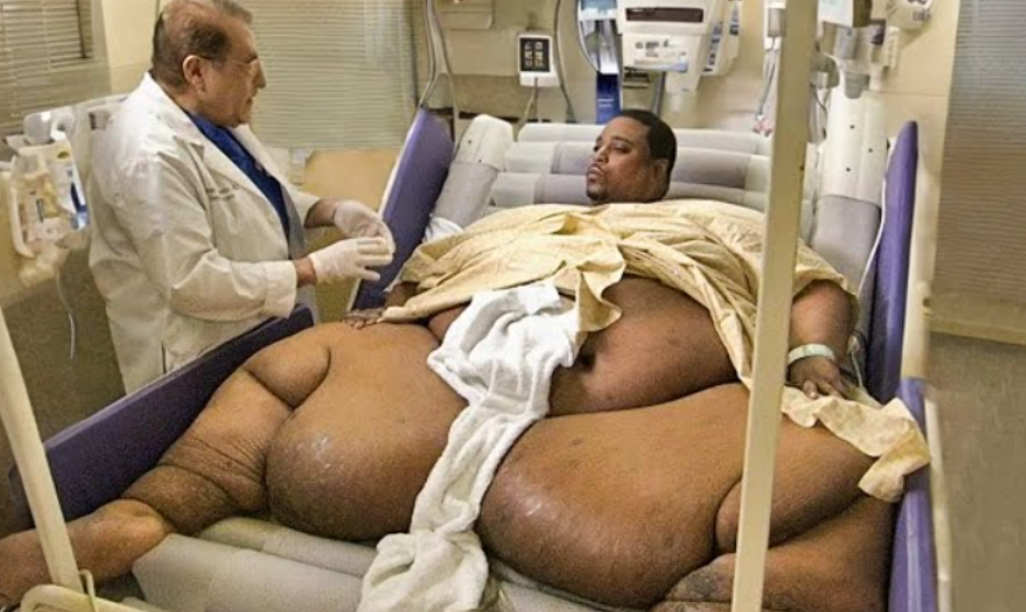 Remember This Man Who Weighed 1022 Pounds? You Won’t Believe How He Looks Now!