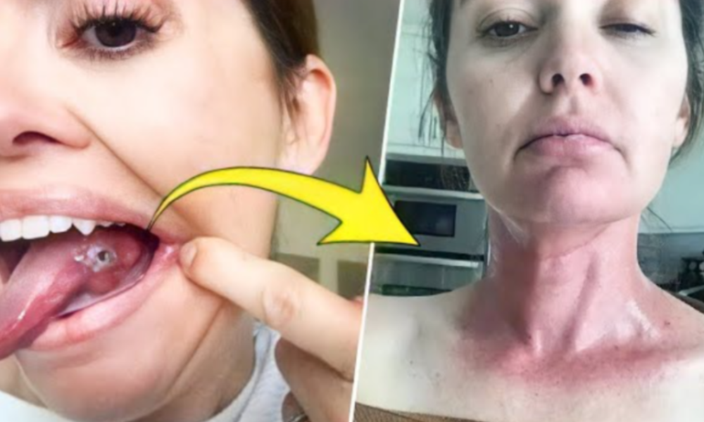 She Thought She Bit Her Tongue While Sleeping, But She Discovered Something That Left Her In Stun
