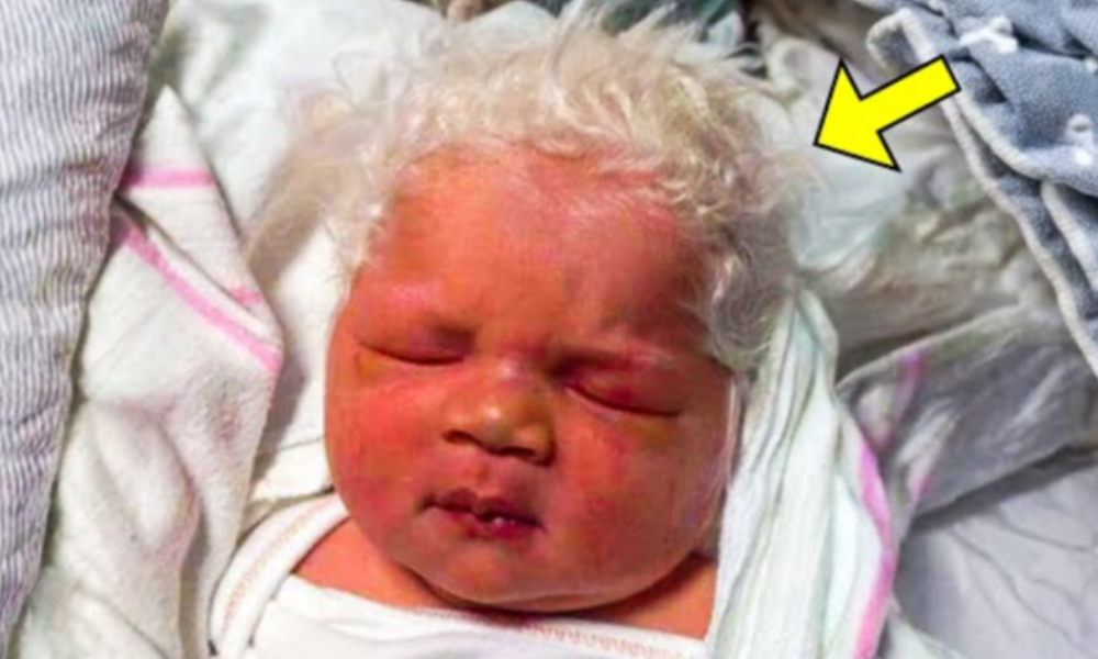 This Baby Was Born With White Hair. The Reason Left Doctors in Shock!