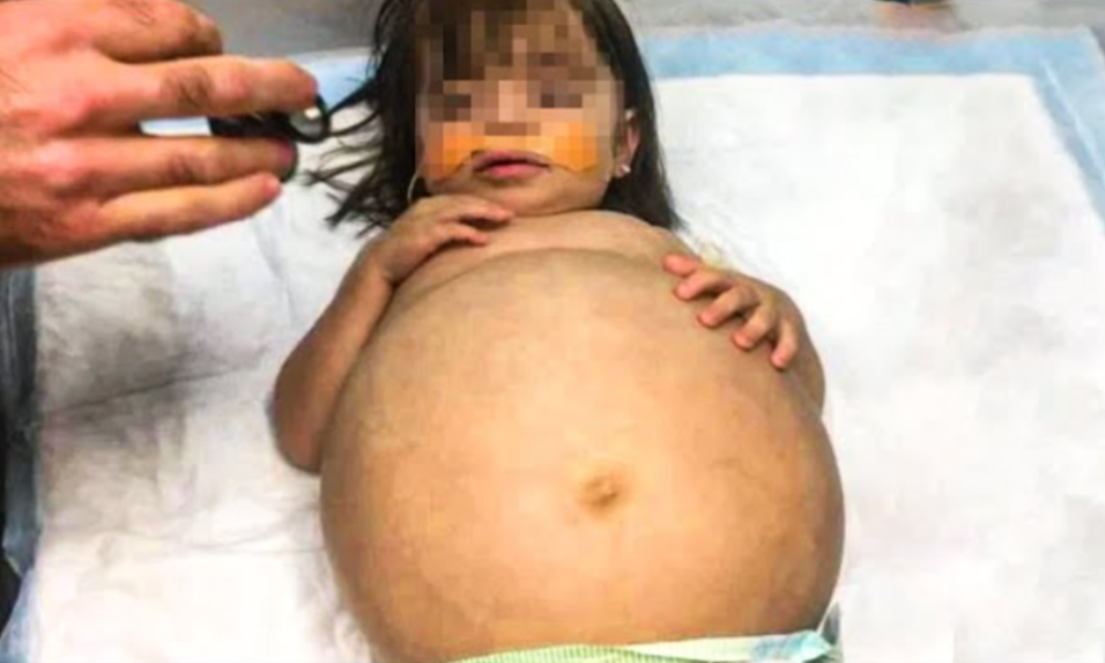 This Baby’s Belly Kept Growing Nonstop, Then The Doctors Delivered The Alarming News To Her Parents