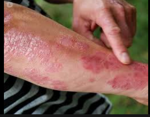 Why Do You Have A Skin Rash? 7 Potential Reasons