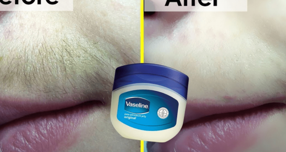 You Can Get Rid Of Unwanted Hair With This Vaseline Trick