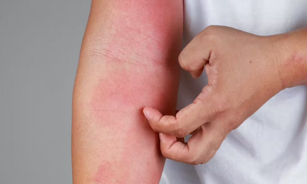 What causes itchy skin? Doctors reveal the 9 common triggers – and when to worry about it