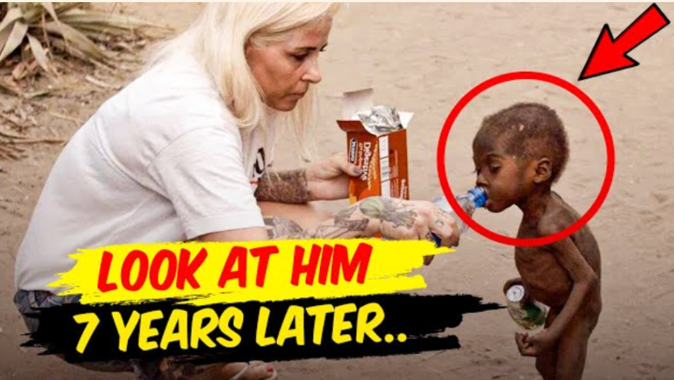 Do You Remember The Child Whose Image Went Viral All Over The World? Here’s How His Life Turned Out