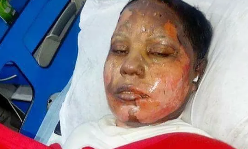 How Muslim Man Sets Christian Woman On Fire For Refusing To Convert To Islam