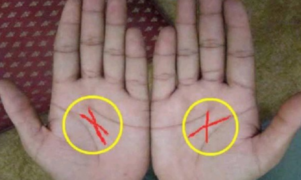 If You Have The X Symbol In Your Palm, This Is What It Says About Your Future
