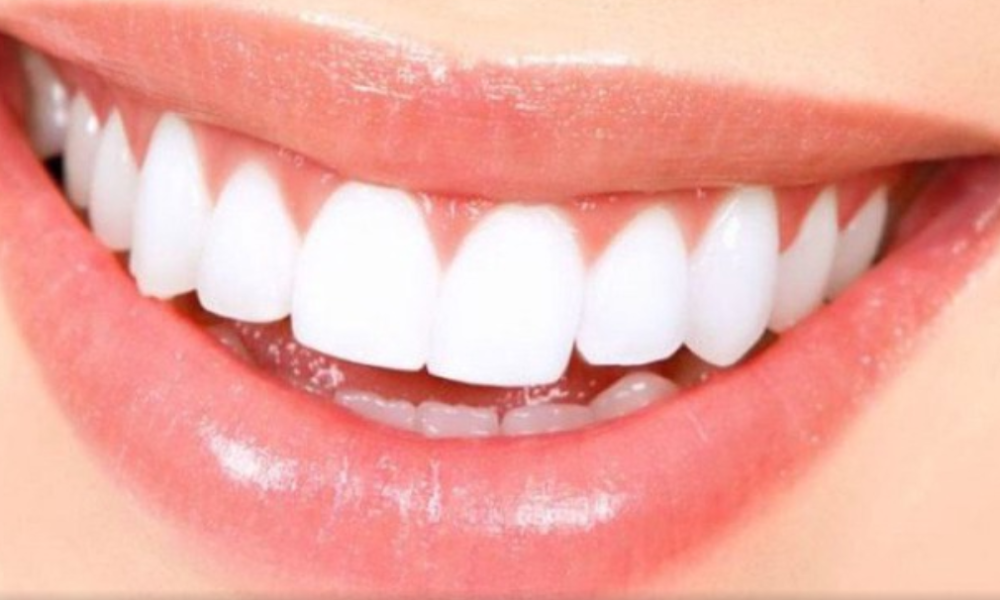 If you want your teeth to shine like pearls then apply just these two things