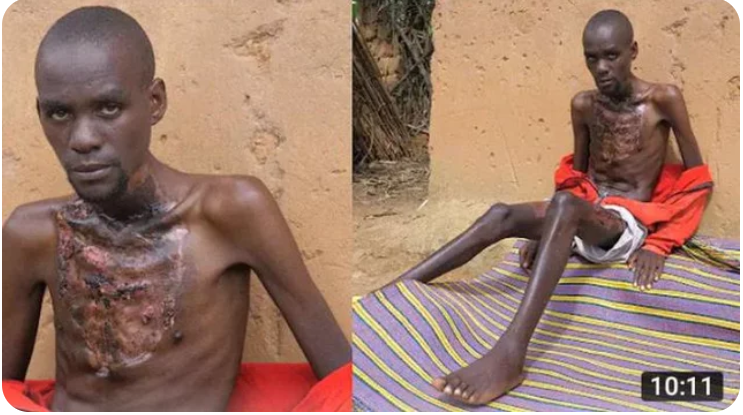 Please Lord, Let Me Die, Take My Life, I’m Tired of Living, This Pain Is Too Much – Man Cries After Suffering From This Disease (Video)
