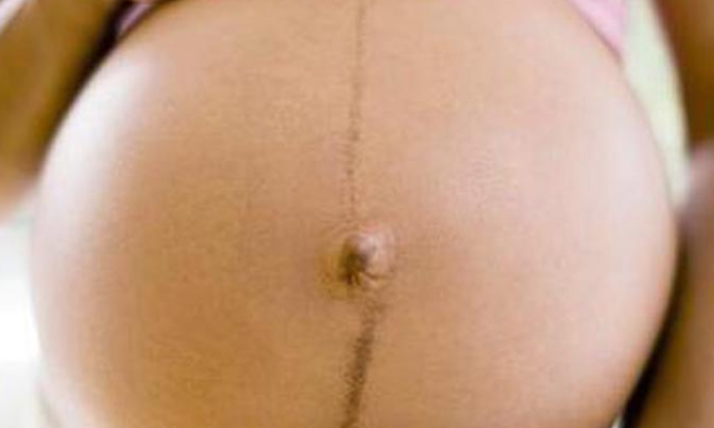 Reason Why Black Line Appear Along The Stomach Of Pregnant Women And It Functions