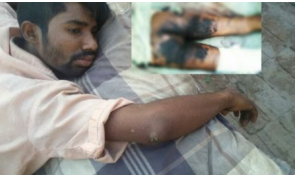 This Christian Man Was Stripped, Burned With Hot Iron Rods For Befriending Muslim Woman