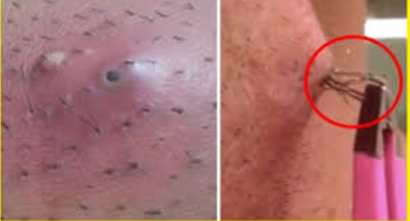What Happens If You Never Shave Your Pubic Hairs?