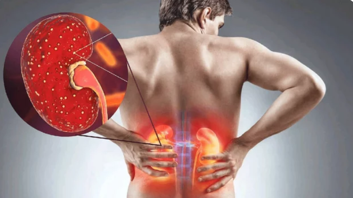 You Are Killing Your Kidney Slowly With These 7 Practices