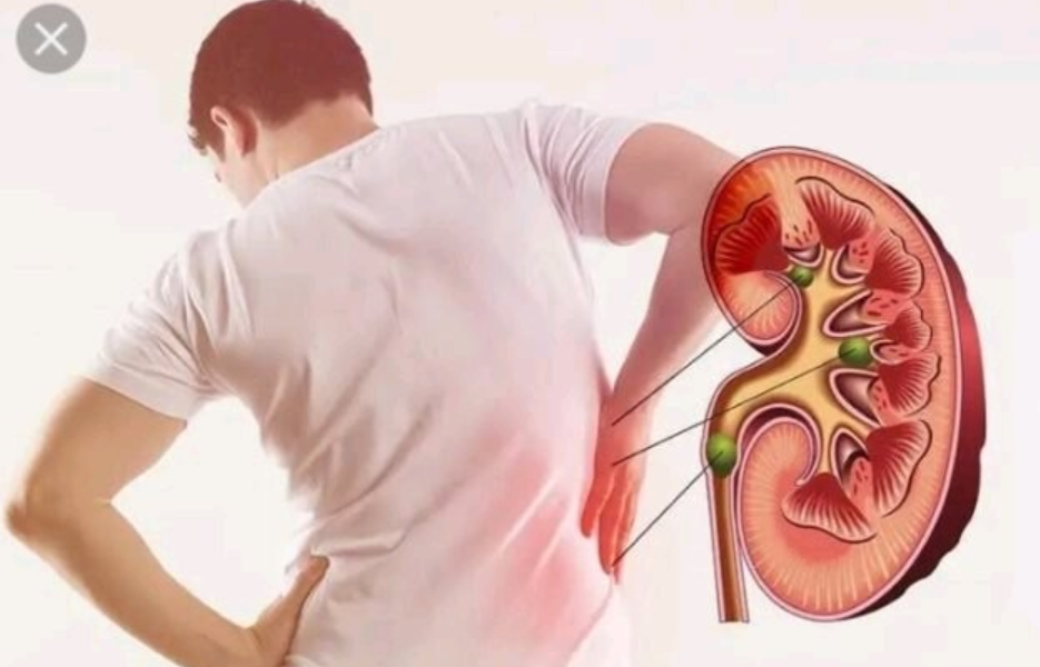 Your kidney is fizzling assuming you experience these signs