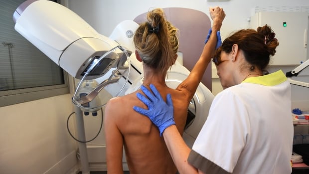 Breast screening at age 40 not routinely advised, Canadian task force says