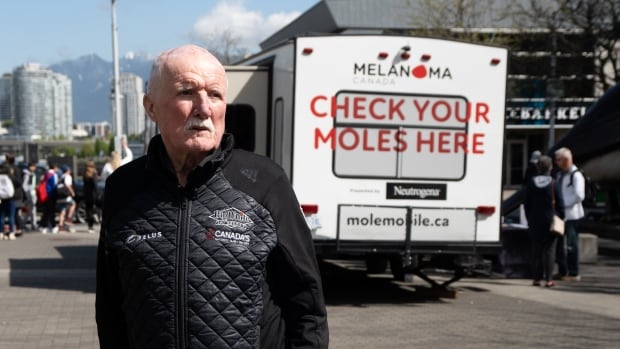 Mole mobiles aim to speed up skin cancer screenings as Canada struggles with dermatologist shortage