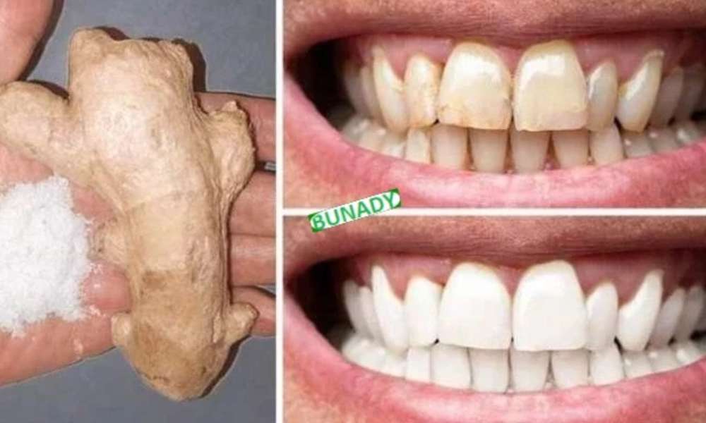 10 natural methods to whiten your teeth at home