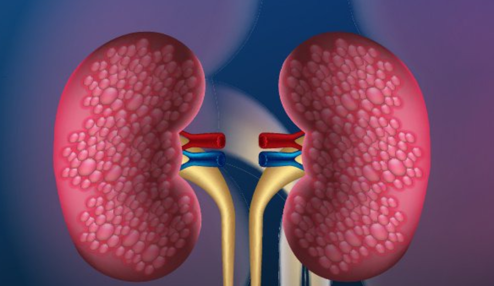 Doctors Recommend Kidney Function Test Once You Begin To Notice These 6 Signs