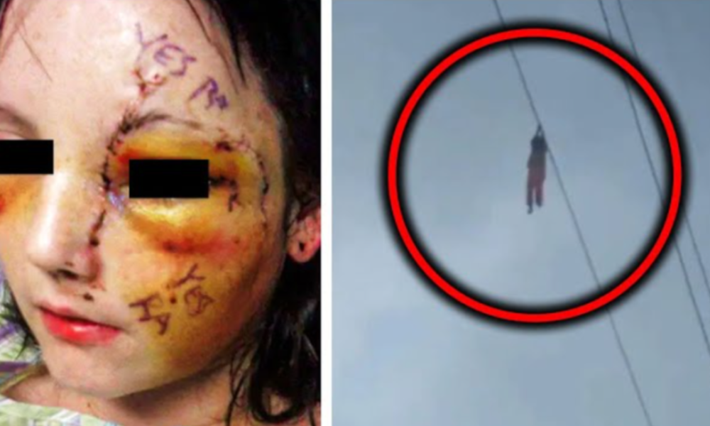 Girl Left Hanging From Power Line – What Actually Happened is Shocking