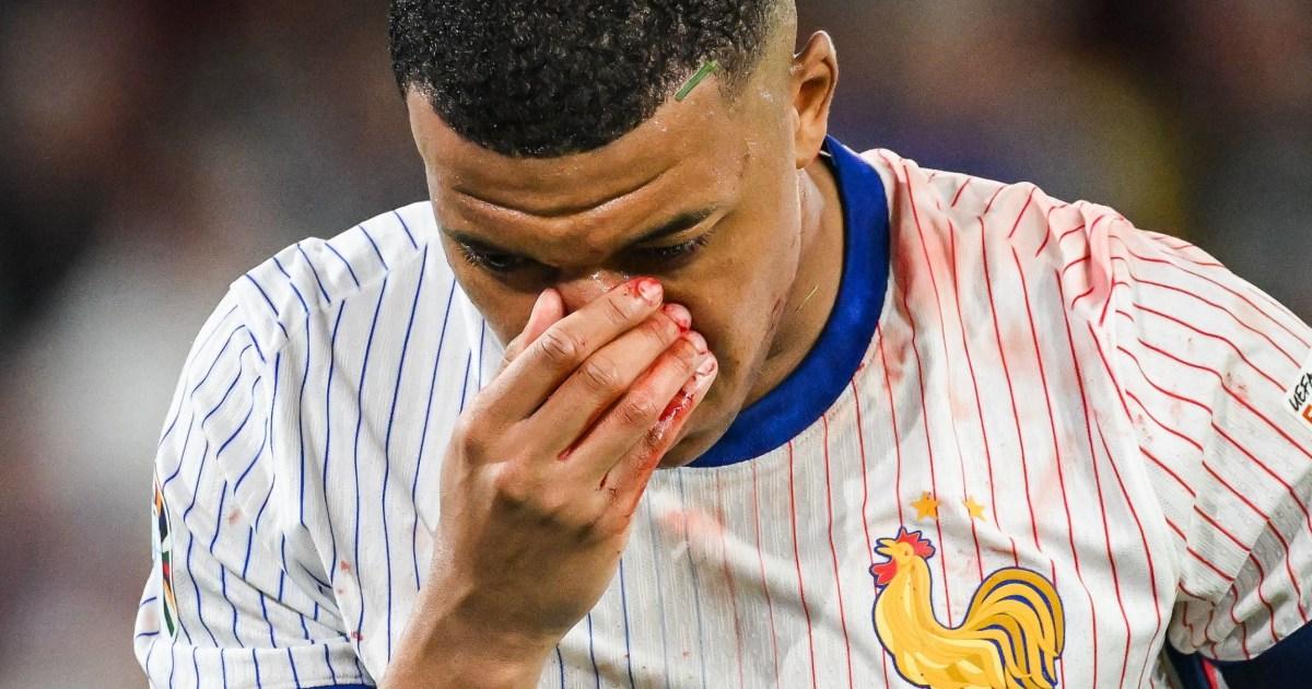 Kylian Mbappe could miss rest of Euro 2024 after being taken to hospital with broken nose | Football