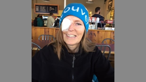 Cancer survivors demand clarity on future of Edmonton facial reconstruction clinic