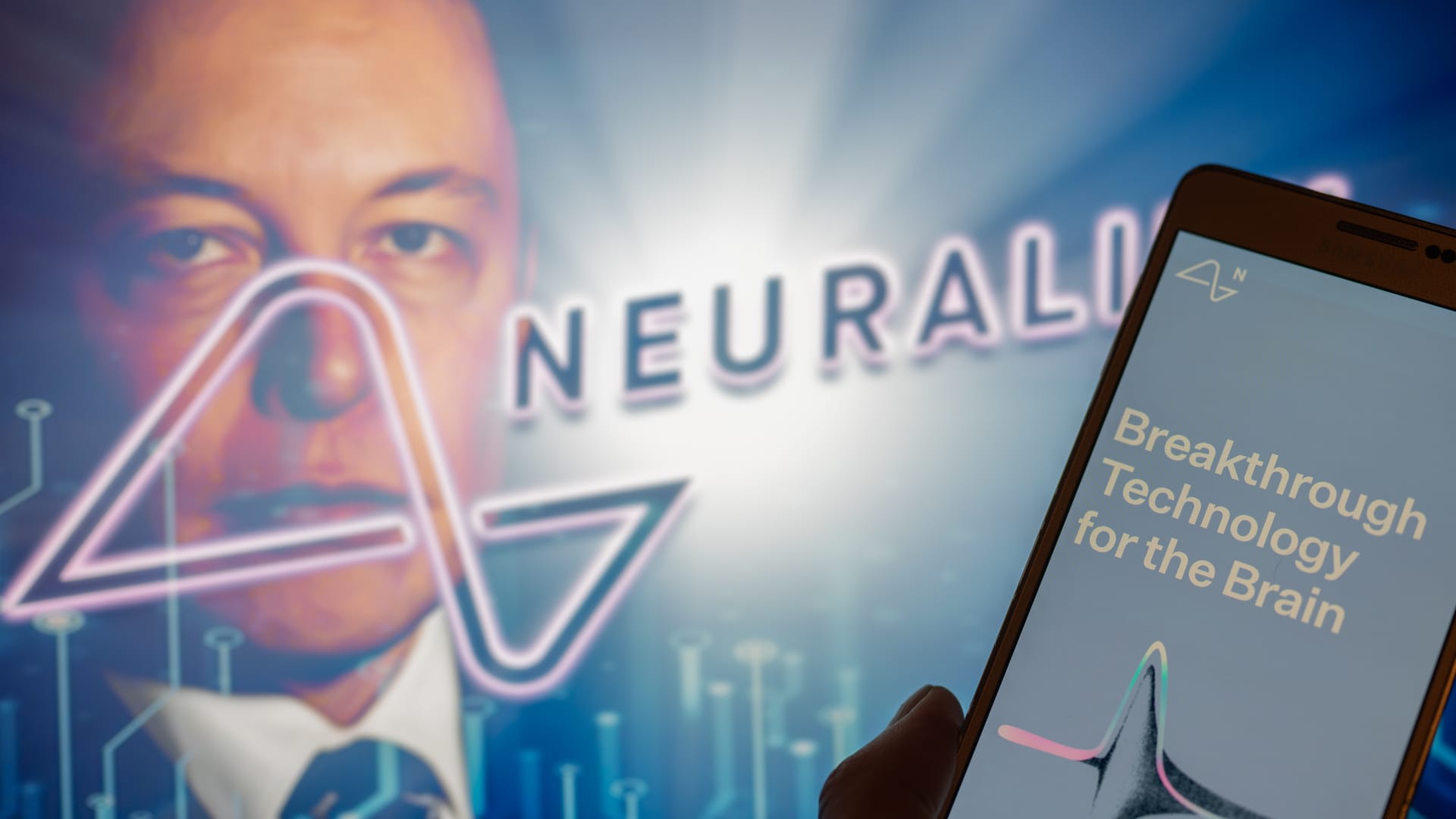 Musk says next Neuralink brain implant expected in 'next week or so'