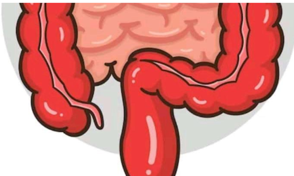 5 Foods That Damage Intestine