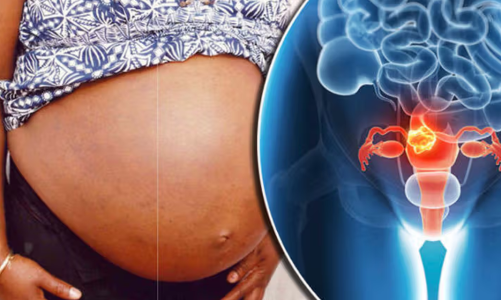 Can you have children after fibroid surgery? Here’s what you should know