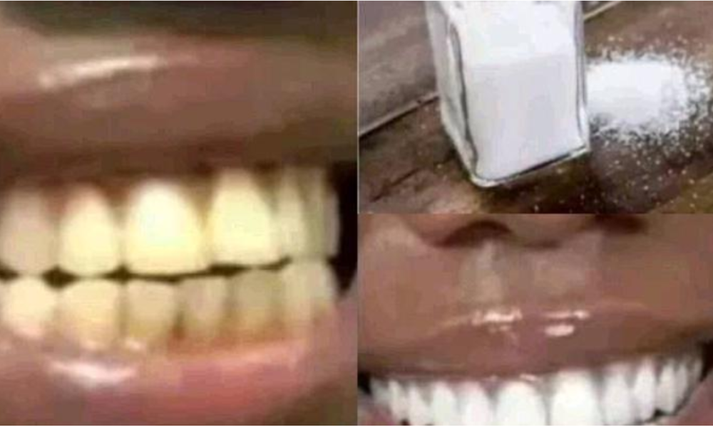 How To Remove Deep Brown Stains From Your Teeth With These Kitchen Ingredients