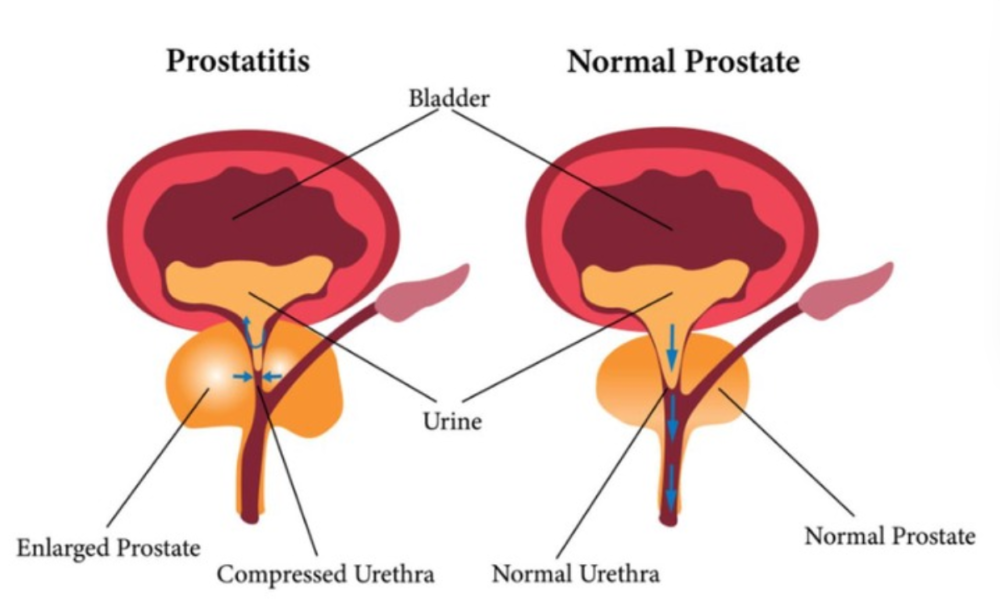How do you know if your prostate is healthy