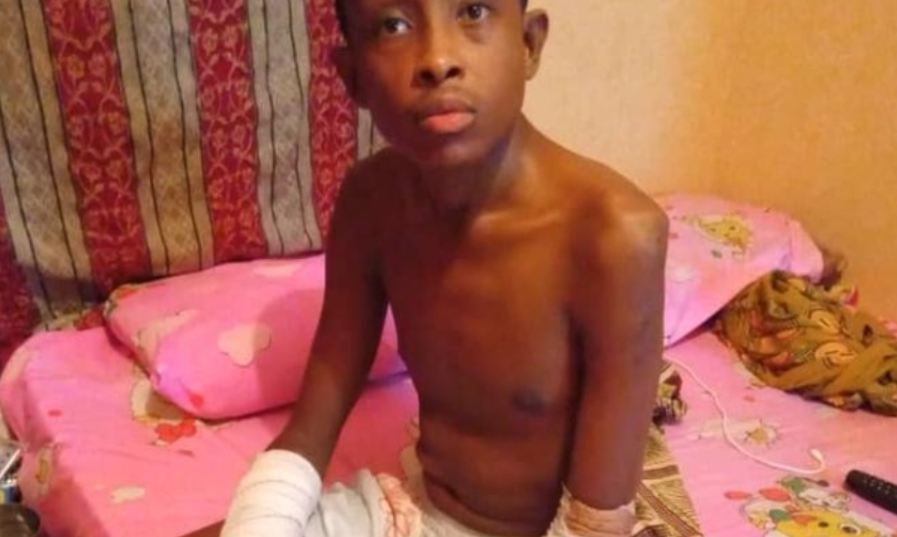 I Will Never Forgive My Parents For Giving Birth To Me Because Of This – Sickle Cell Amputee Who Lost Two Siblings (Video)