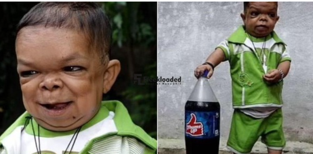 Photo Of 25-Year-Old Man Who Stopped Growing In Height At Age 5 Goes Viral