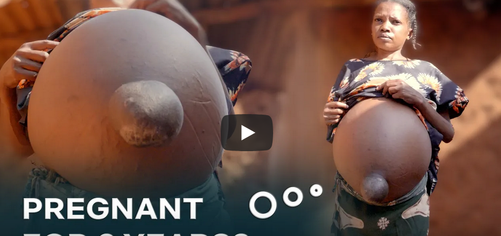 They Say I Have Been Pregnant For 6 Years : I DON’T KNOW WHAT WILL HAPPEN NEXT (Video)