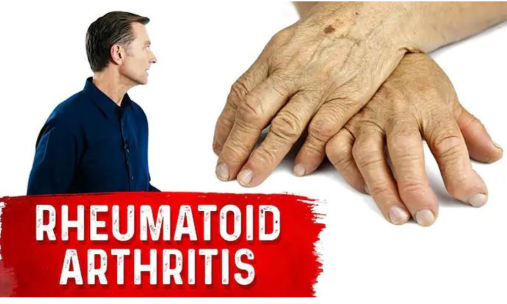 Use These Spices and Herbs for Rheumatoid Arthritis – Remedies for Rheumatoid Arthritis