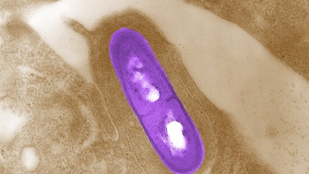 Here's what you should know about Listeria contaminations in Canada