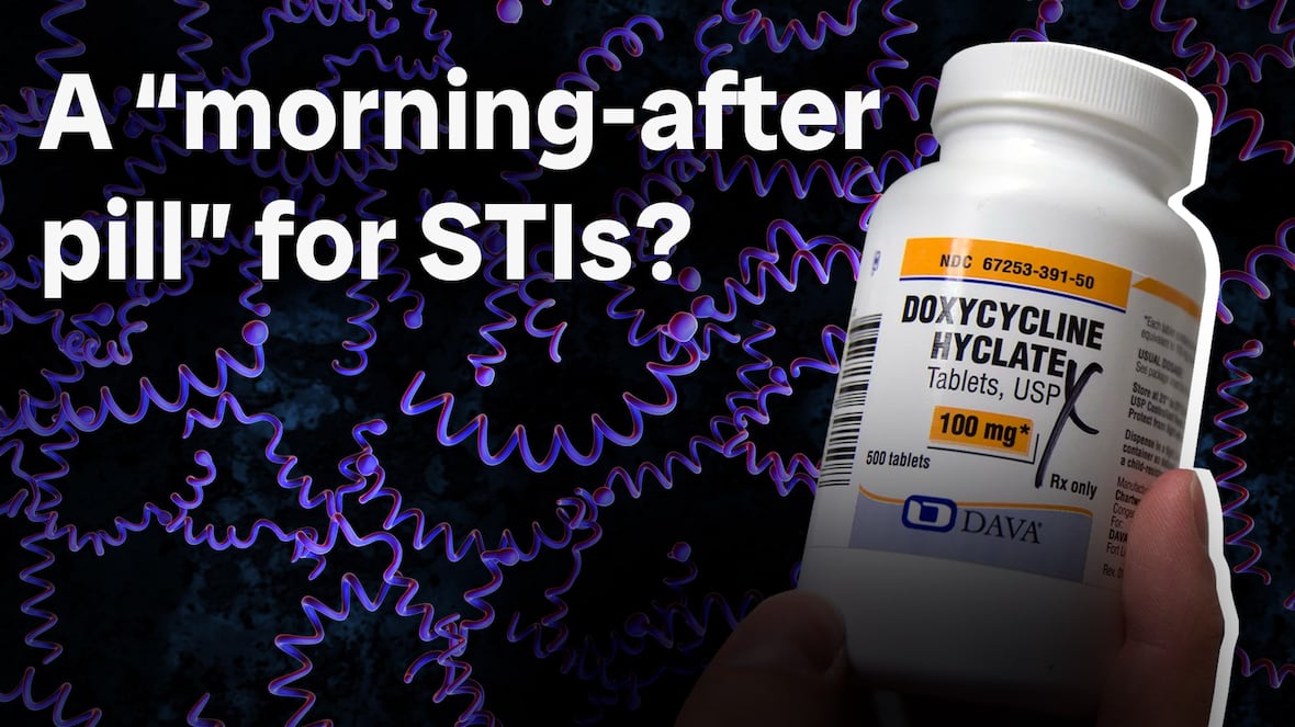 Is this a ‘morning-after pill’ for STIs?