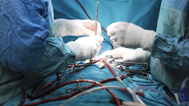 Surgical waits vary a lot between Ontario hospitals: study