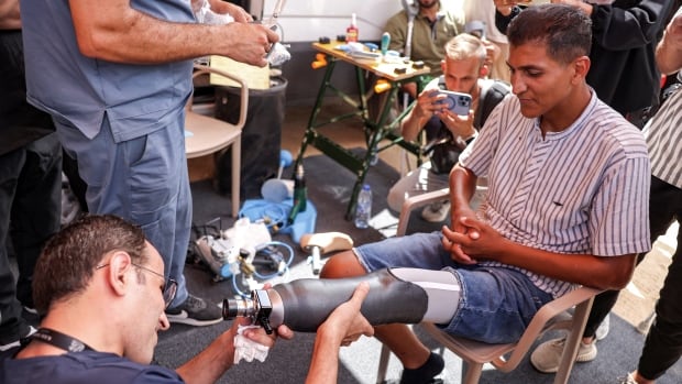 Gaza man's 'soul returned to life' upon getting new prosthetic leg