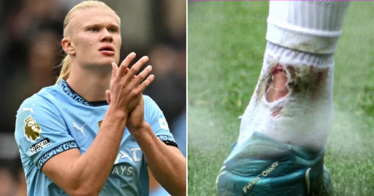 Pep Guardiola provides Erling Haaland injury update | Football