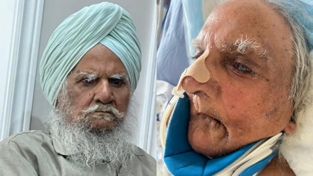 Sikh man was shaved without consent at Brampton hospital: complaint