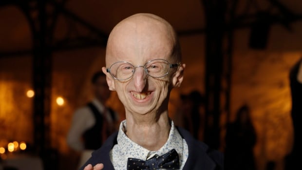 'There's nobody like him': Sammy Basso, longest survivor of rapid ageing disease, dies at 28